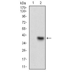Complement Component 1q Receptor / C1QR1 (CD93) Antibody