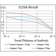 Fig. 1. Black line: Control Antigen (100 ng); Purple line: Antigen(10ng); Blue line: Antigen (50 ng); Red line: Antigen (100 ng)