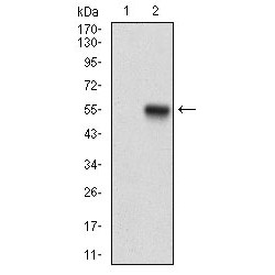 Protein Phosphatase 1 Regulatory Subunit 1B (PPP1R1B) Antibody