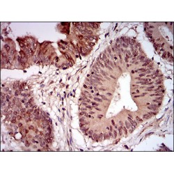 Nibrin (NBN) Antibody