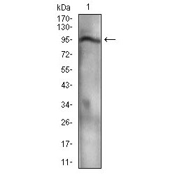 Nibrin (NBN) Antibody