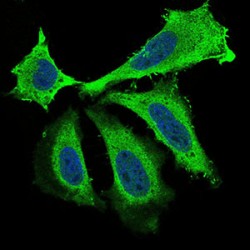 Brain-Derived Neurotrophic Factor (BDNF) Antibody