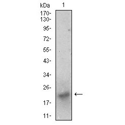 Brain-Derived Neurotrophic Factor (BDNF) Antibody