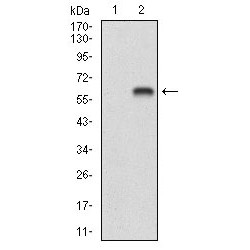 Brain-Derived Neurotrophic Factor (BDNF) Antibody