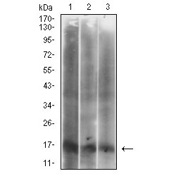 Cyclin-Dependent Kinase Inhibitor 2A (CDKN2A) Antibody