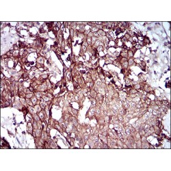 Desmoglein 3 (DSG3) Antibody