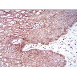 Desmoglein 3 (DSG3) Antibody