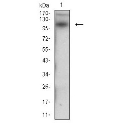 Desmoglein 3 (DSG3) Antibody