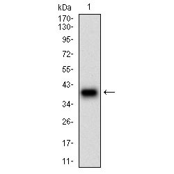 Desmoglein 3 (DSG3) Antibody