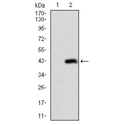 Desmoglein 3 (DSG3) Antibody