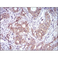 Epithelial Cell Adhesion Molecule (EPCAM) Antibody