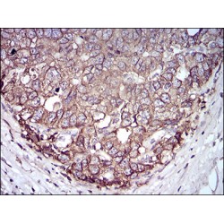 Epithelial Cell Adhesion Molecule (EPCAM) Antibody