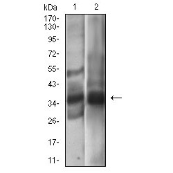 Epithelial Cell Adhesion Molecule (EPCAM) Antibody