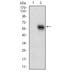 Epithelial Cell Adhesion Molecule (EPCAM) Antibody