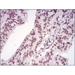 Menin (MEN1) Antibody