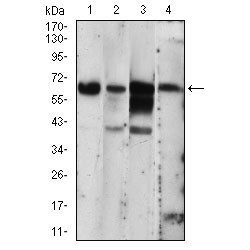 Interferon-Induced, Double-Stranded RNA-Activated Protein Kinase (EIF2AK2) Antibody