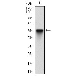 Interferon-Induced, Double-Stranded RNA-Activated Protein Kinase (EIF2AK2) Antibody