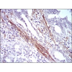 Calponin 1 (CNN1) Antibody