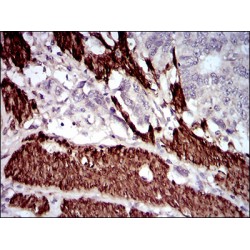 Calponin 1 (CNN1) Antibody