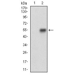 Calponin 1 (CNN1) Antibody