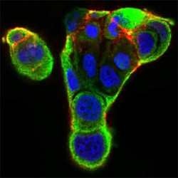 X-Ray Repair Cross-Complementing Protein 6 (XRCC6) Antibody