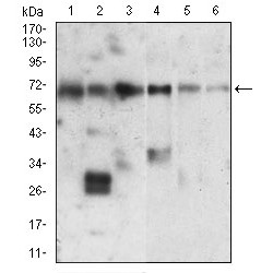 X-Ray Repair Cross-Complementing Protein 6 (XRCC6) Antibody