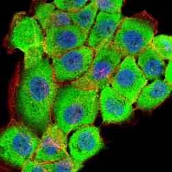 Ribosomal Protein S6 Kinase Alpha-2 (RPS6KA2) Antibody