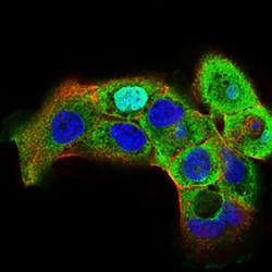 Heat Shock Factor Protein 1 (HSF1) Antibody