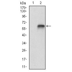 Vitronectin (VTN) Antibody