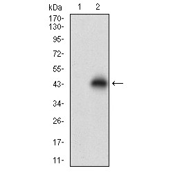 T-Cell Leukemia/lymphoma Protein 1A (TCL1A) Antibody