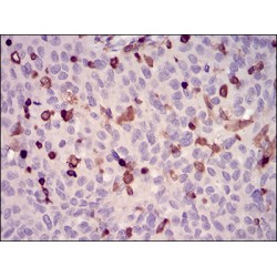 Wiskott-Aldrich Syndrome Protein (WAS) Antibody