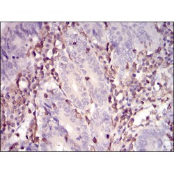 Wiskott-Aldrich Syndrome Protein (WAS) Antibody