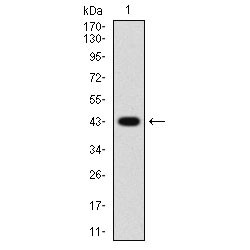 Platelet Derived Growth Factor Receptor Alpha (PDGFRA) Antibody