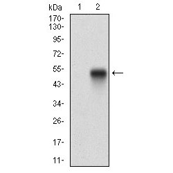 Platelet Derived Growth Factor Receptor Alpha (PDGFRA) Antibody