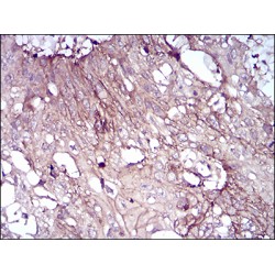 T-Cell Differentiation Antigen CD6 (CD6) Antibody