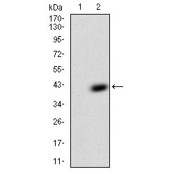 Trefoil Factor 2 (TFF2) Antibody