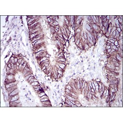 Cadherin-17 (CDH17) Antibody