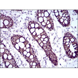 Cadherin-17 (CDH17) Antibody