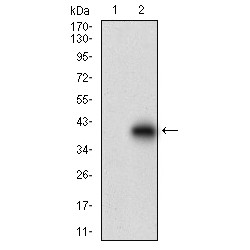 Cadherin-17 (CDH17) Antibody