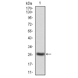 Tyrosine-Protein Kinase JAK2 (JAK2) Antibody