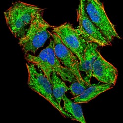 Luteinizing Hormone/Choriogonadotropin Receptor (LHCGR) Antibody