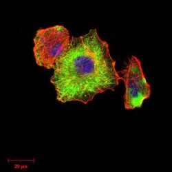 Tubulin Beta 1 (TUBB1) Antibody