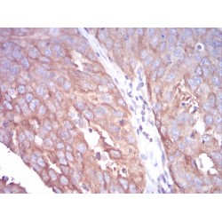 Tubulin Beta 1 (TUBB1) Antibody