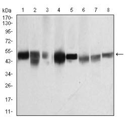 Tubulin Beta 1 (TUBB1) Antibody