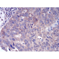 Fibroblast Growth Factor Receptor 3 (FGFR3) Antibody