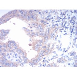 Fibroblast Growth Factor Receptor 3 (FGFR3) Antibody