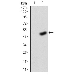 Fibroblast Growth Factor Receptor 3 (FGFR3) Antibody