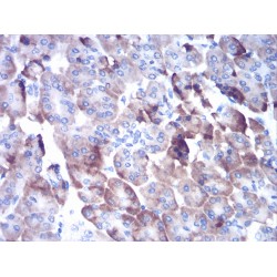 Cathepsin D (CTSD) Antibody