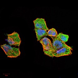 DNA Excision Repair Protein ERCC-1 (ERCC1) Antibody