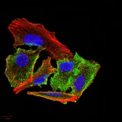 Transthyretin (TTR) Antibody